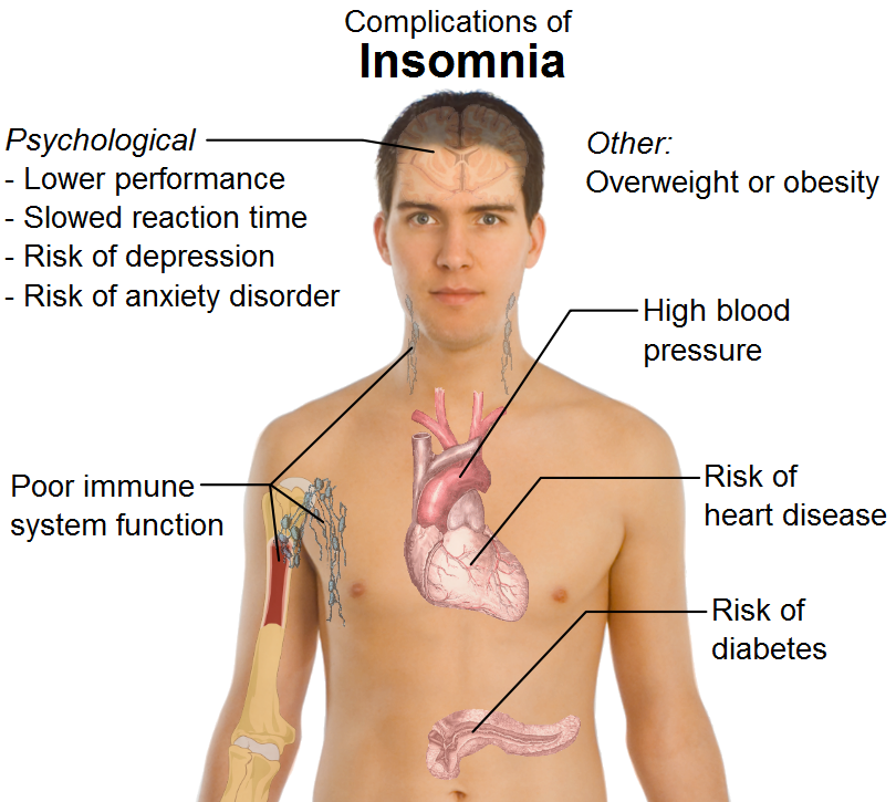 insomnia research papers