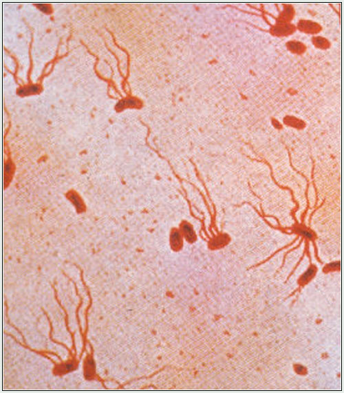 Typhoid Typhoid